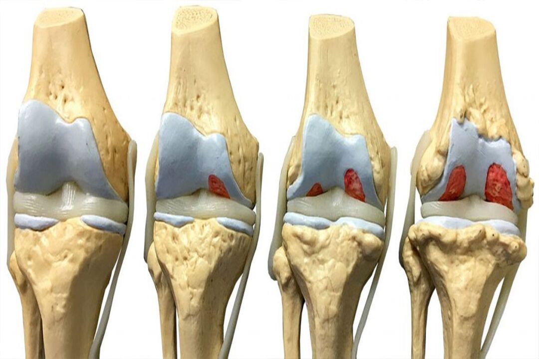 stages of joint development