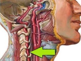 spinal