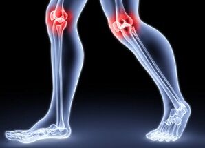 The reasons for the development of arthritis in the knee