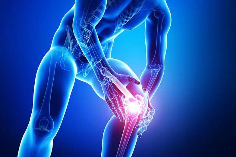 symptoms of arthritis